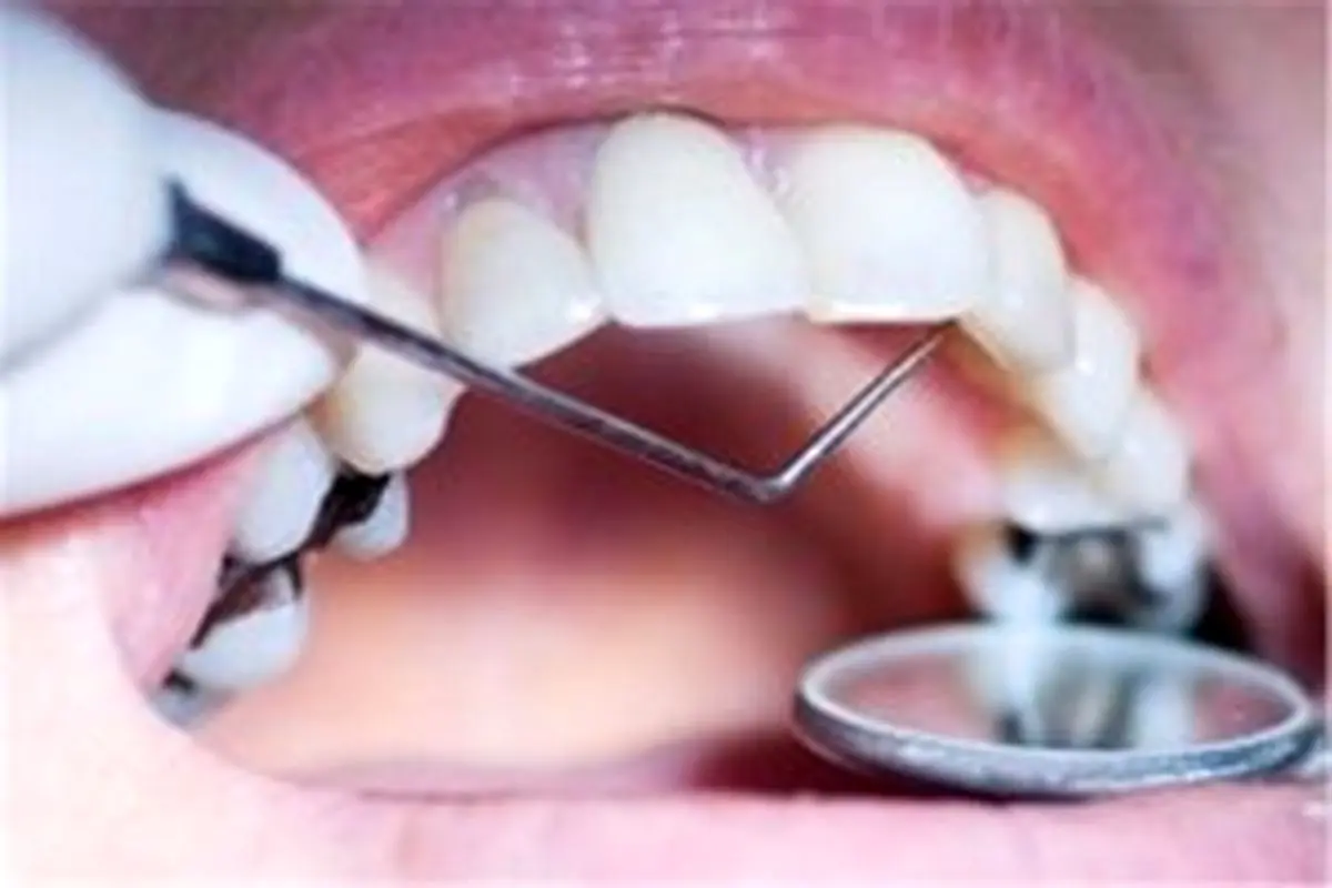 چه عواملی باعث افزایش احتمال ابتلا به سرطان‌های دهان میشود؟