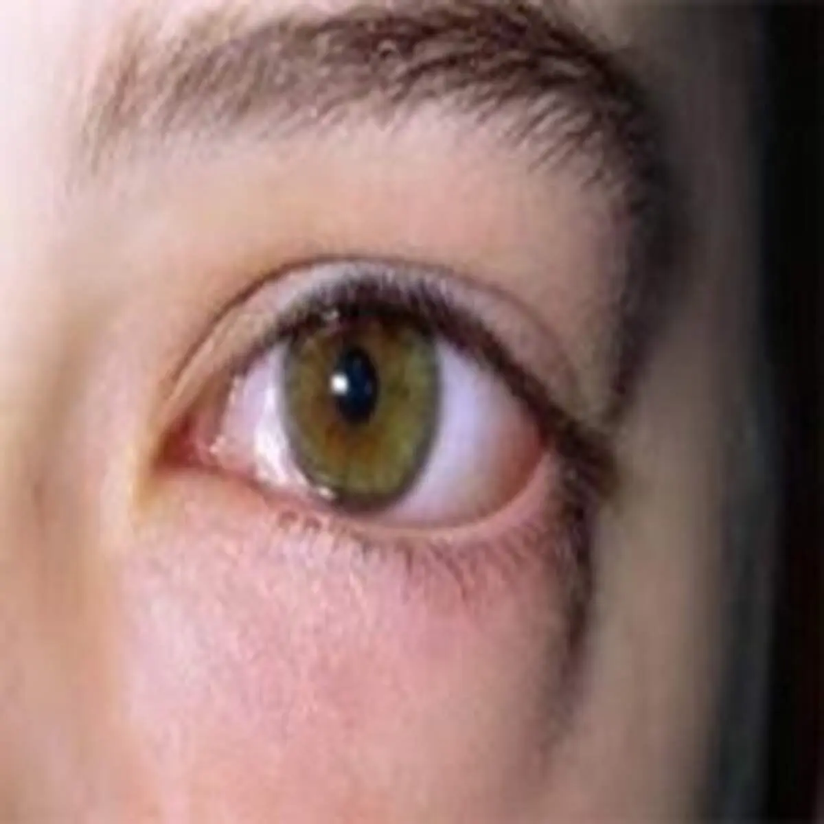 چرا چشم‌ها خشک می‌شود؟