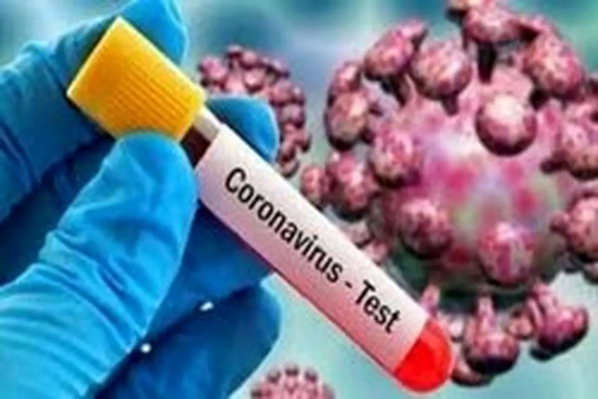 برای تشخیص کرونا به آزمایشگاههای خصوصی نروید