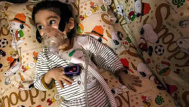 ۳۳۲ نوع بیماری نادر در ایران تایید شده است