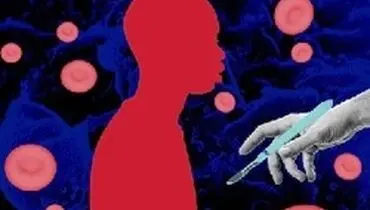 بهترین روش برای پیشگیری از ایدز ختنه کردن!