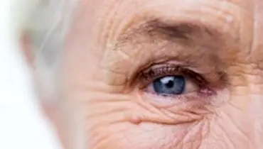 اختلالات بینایی در کدام بیماران شایع است؟