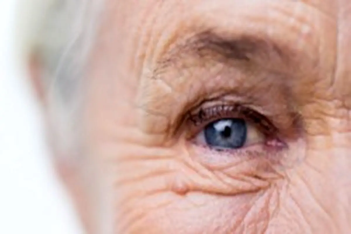 اختلالات بینایی در کدام بیماران شایع است؟