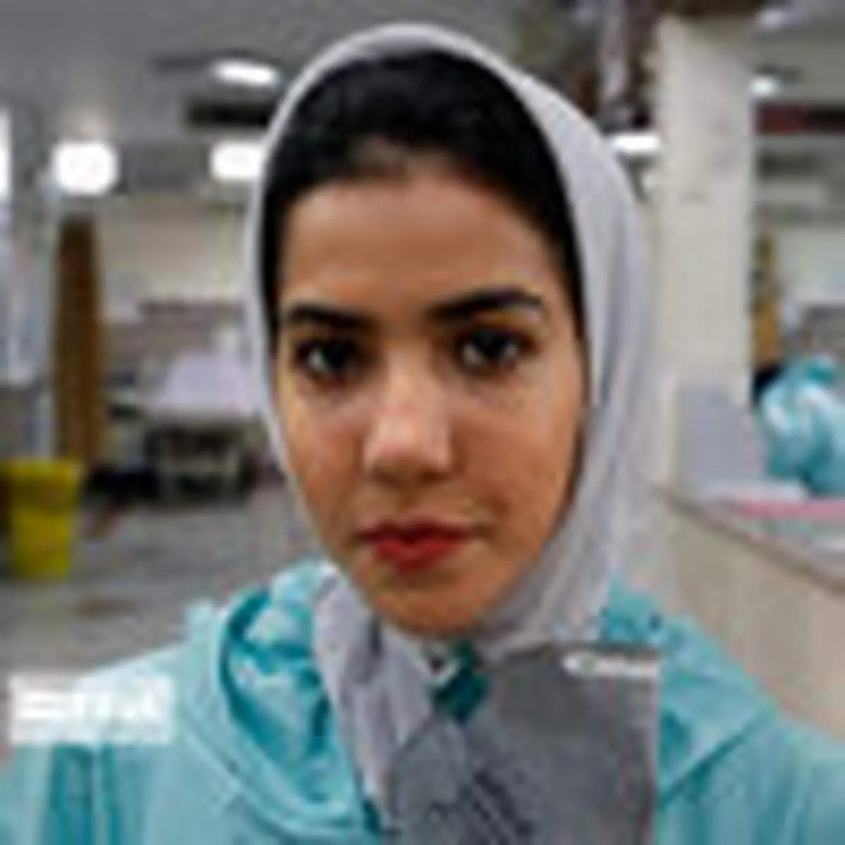 اثر جای ماسک بر صورت جهادگران سلامت