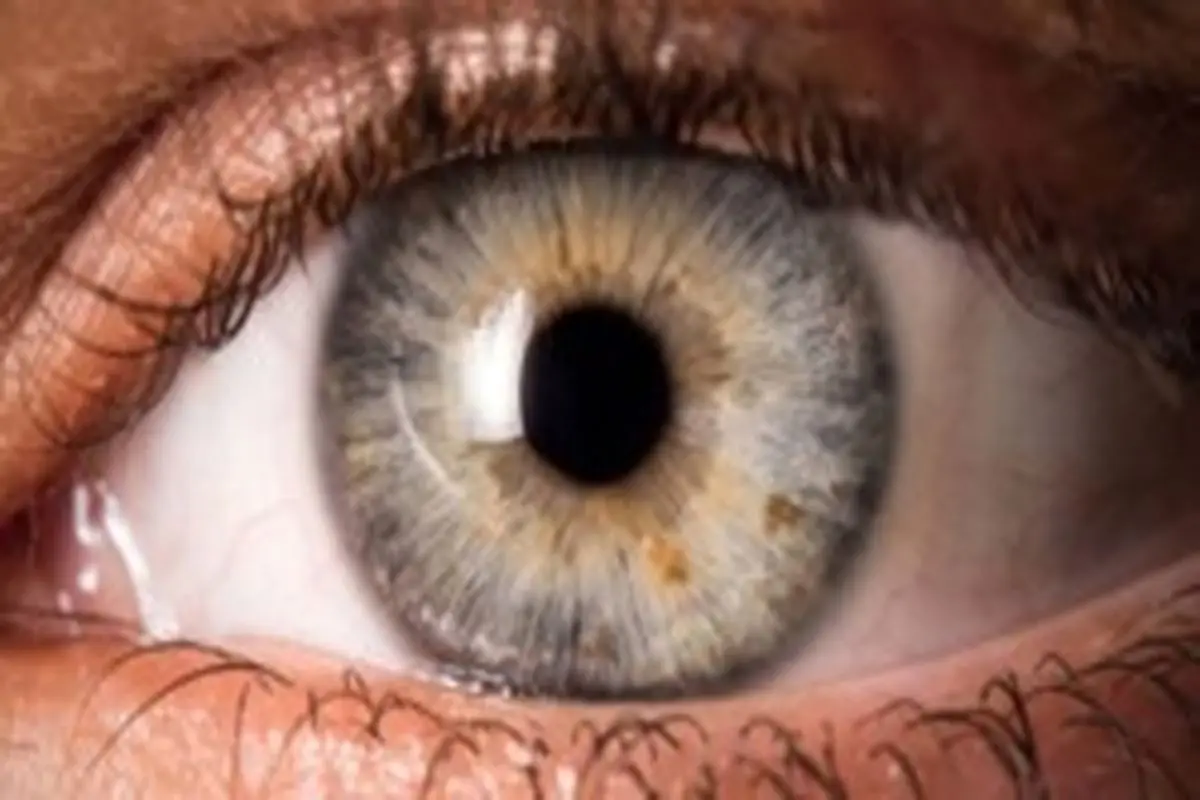 آیا قرمزی چشم یکی از علائم مبتلایان به ویروس کرونا است؟