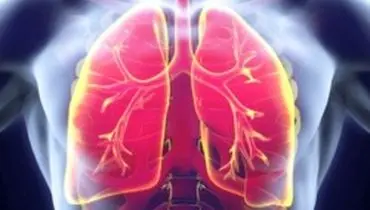 بیماری انسداد ریوی عامل افزایش خطر سرطان ریه در افراد غیرسیگاری