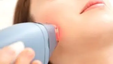 لیزر مو‌های زاید برای چه کسانی مناسب نیست؟