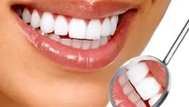 در روز‌های قرنطینه چگونه دندان هایمان را سفید کنیم؟