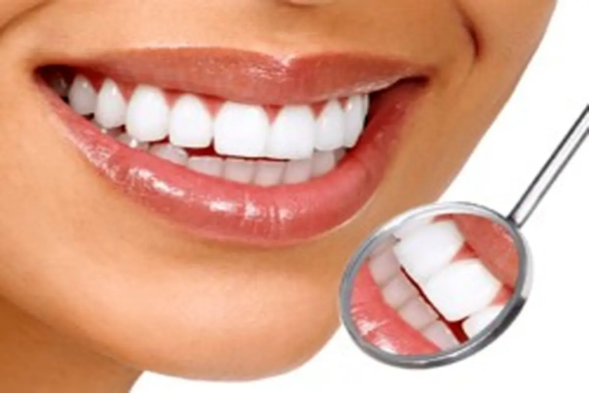 در روز‌های قرنطینه چگونه دندان هایمان را سفید کنیم؟