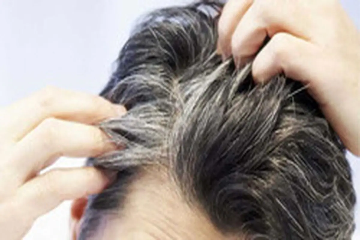 آیا استرس به سفید شدن زودرس مو‌ها منجرمی شود؟