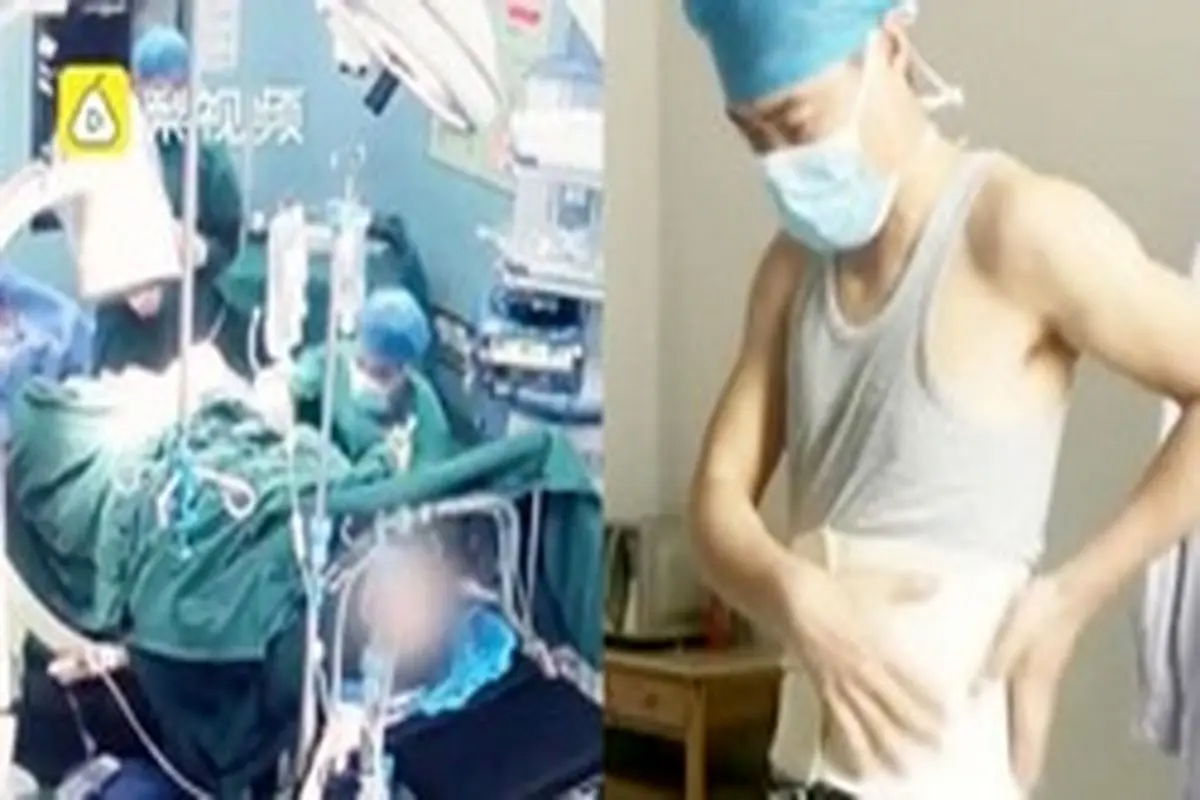 ویدیو/لحظه سقوط پزشک جراح حین عمل جراحی