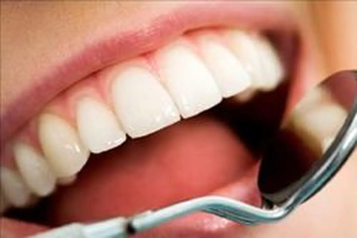 آیا پر کردن و ترمیم دندان روزه را باطل می‌کند؟
