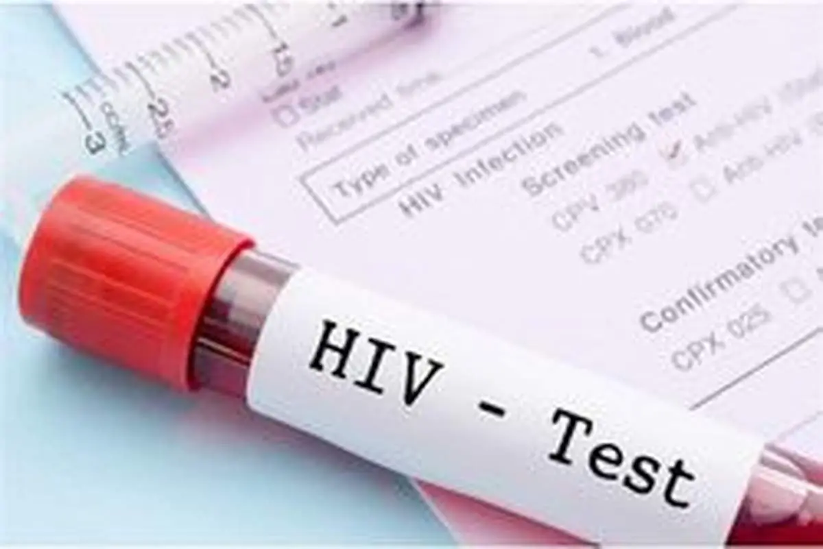 نشانههای ابتدایی HIV در زنان