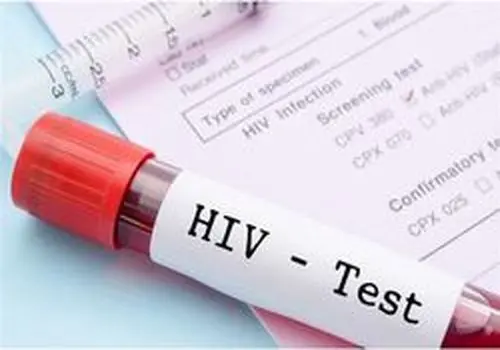 بیشترین شیوع HIV در این بازه سنی