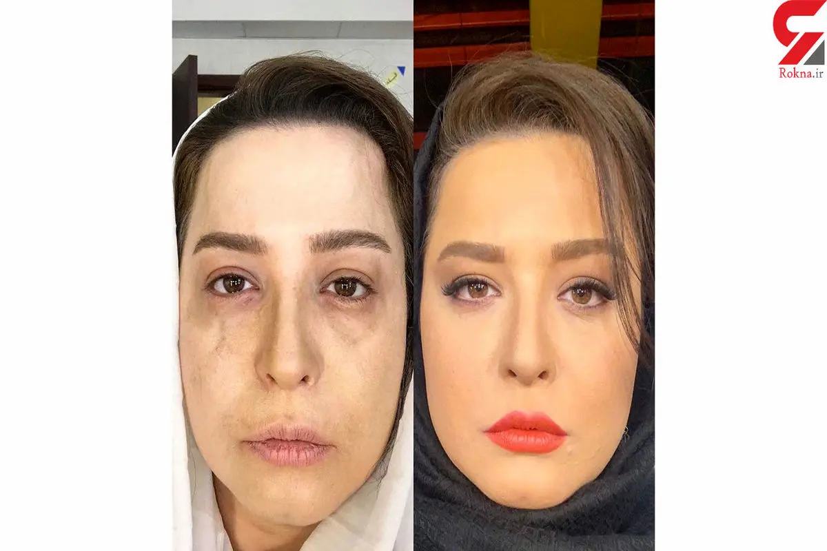 عکس قبل و بعد از خودکشی خانم بازیگر سریال "دل"