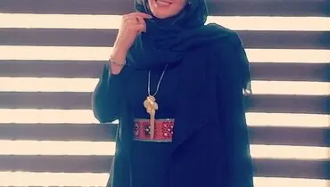 تغییر چهره خانم بازیگر/ عکس