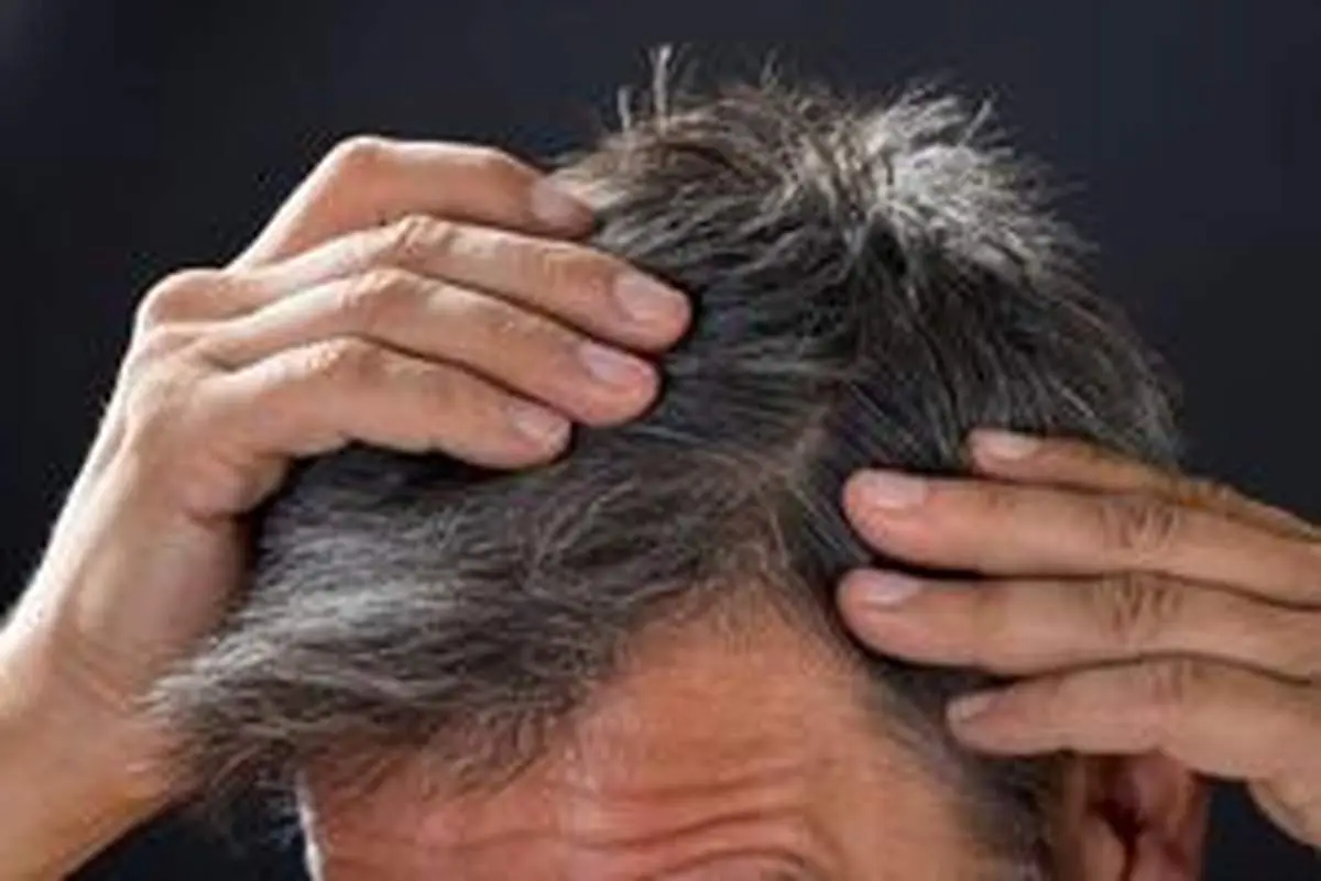 آیا استرس موجب سفید شدن مو میشود؟