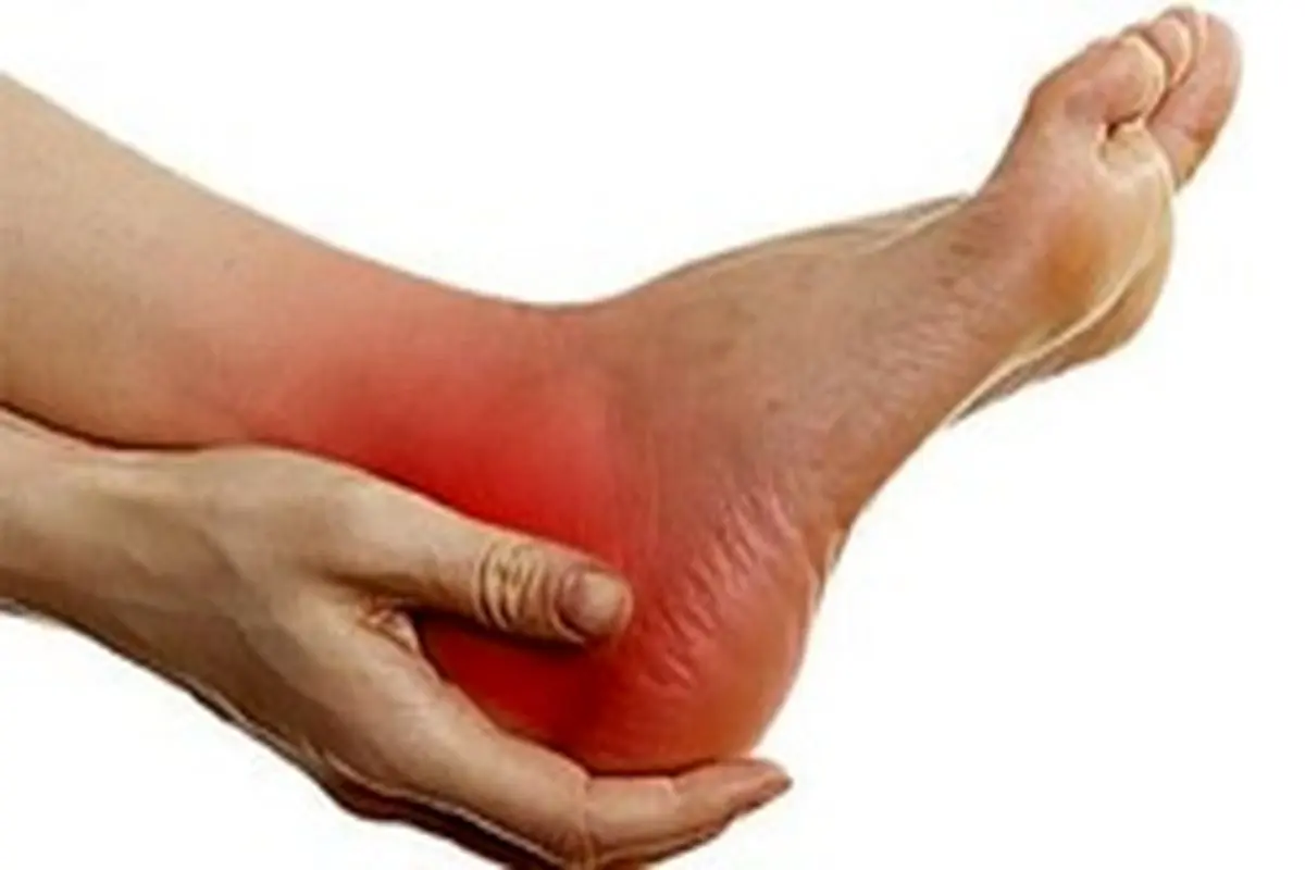 تفاوت درد پاشنه پا و خارپاشنه / روش‌های بهبود درد پاشنه پا