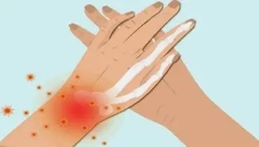 کدام خوراکی ها باعث التهاب در بدن می‌شوند؟