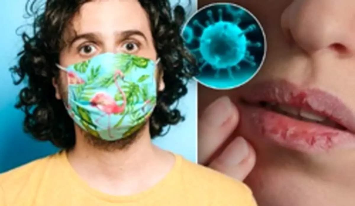 تغییرات عجیب لب‌ها بر اثر ابتلا به ویروس کرونا