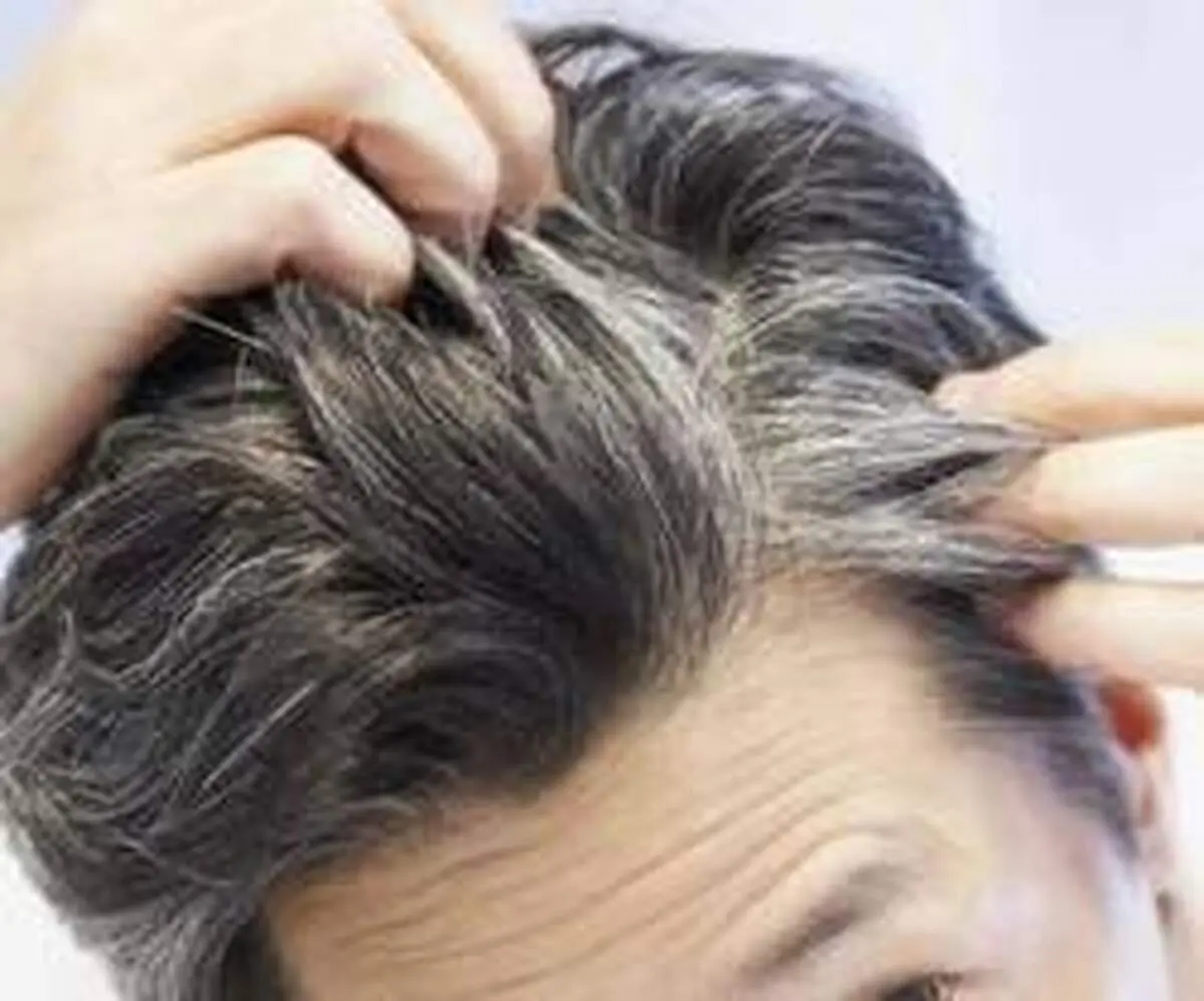 روش های مقابله با سفیدی مو