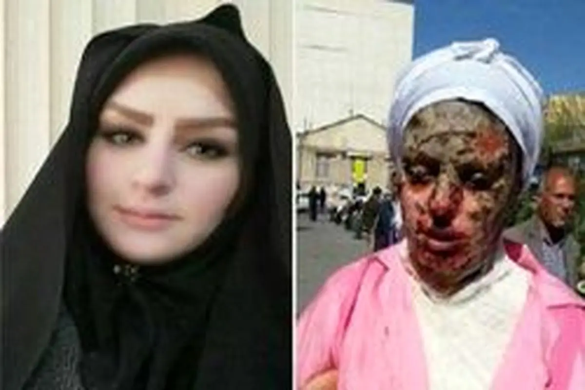 جزئیات مرگ عامل اسیدپاشی به دختر تبریزی در زندان + عکس چهره معصومه قبل و بعد از اسیدپاشی