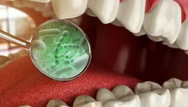 تاثیر باکتری‌های دهانی بر افزایش التهاب روده