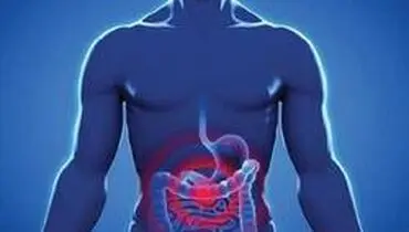علائم سندروم روده تحریک پذیر چیست؟