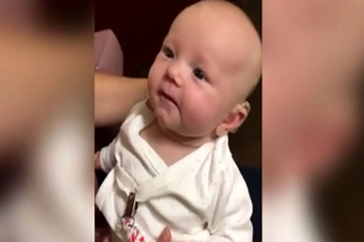 واکنش نوزاد ناشنوا از شنیدن صدای مادرش با کمک سمعک + فیلم