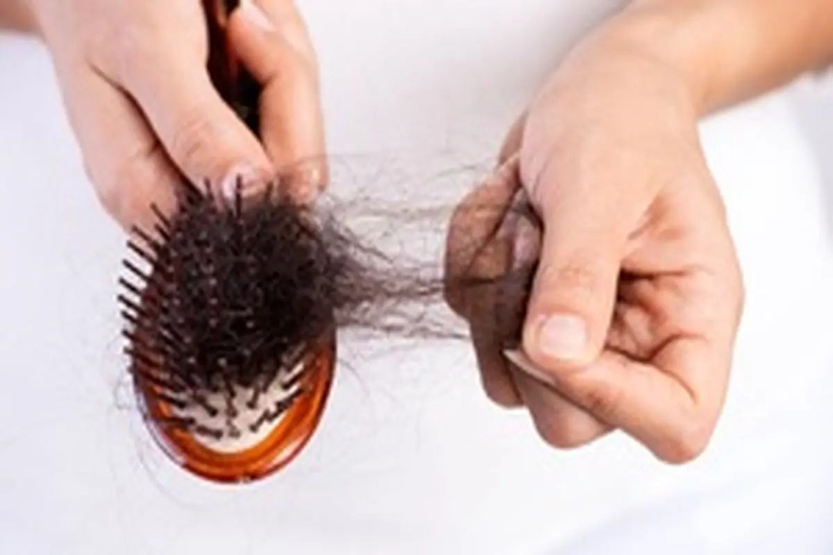 مهم‌ترین علل ریزش مو در خانم ها چیست؟