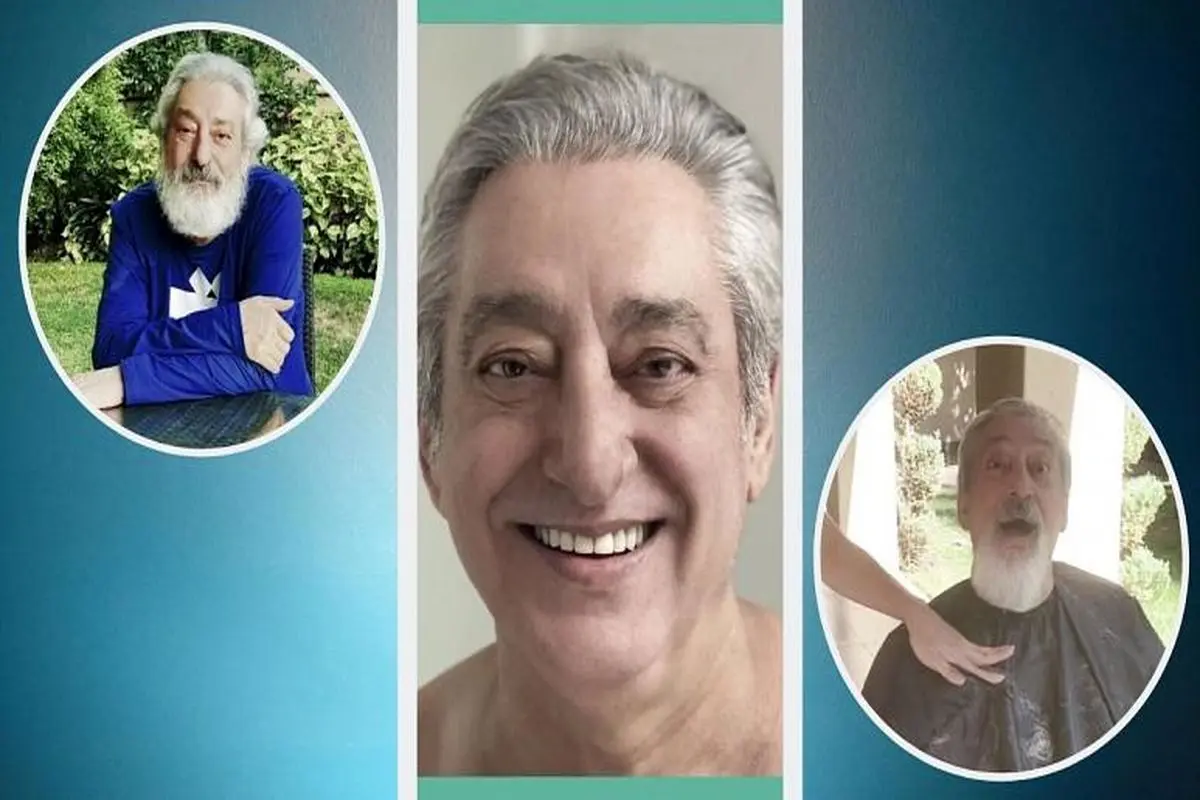 چهره متفاوت و بدون ریش «ابی» بعد از ۵۰ سال +عکس