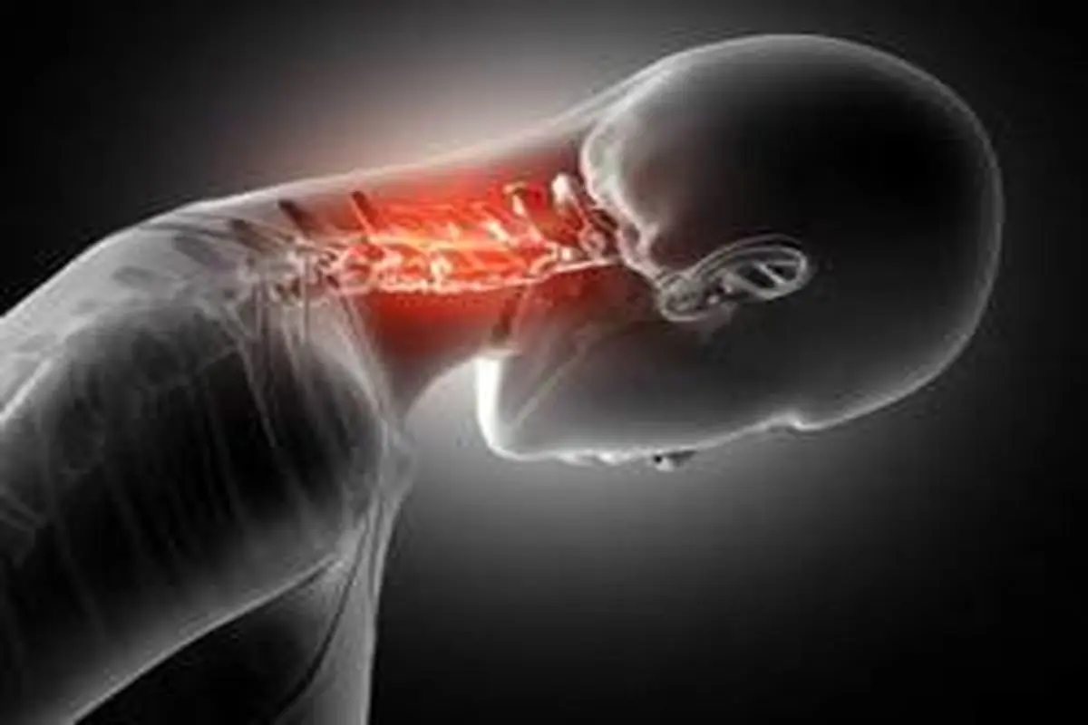 عوامل موثر در ایجاد قوز گردن چیست؟