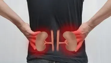 کلیه‌ها و دلایل احساس درد در آن‌ها