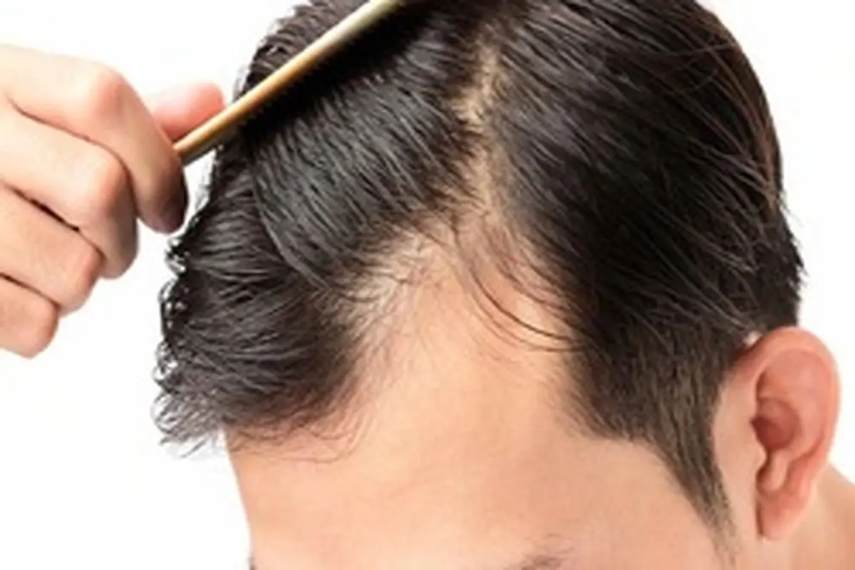 راهکارهای درمان خشکی مو