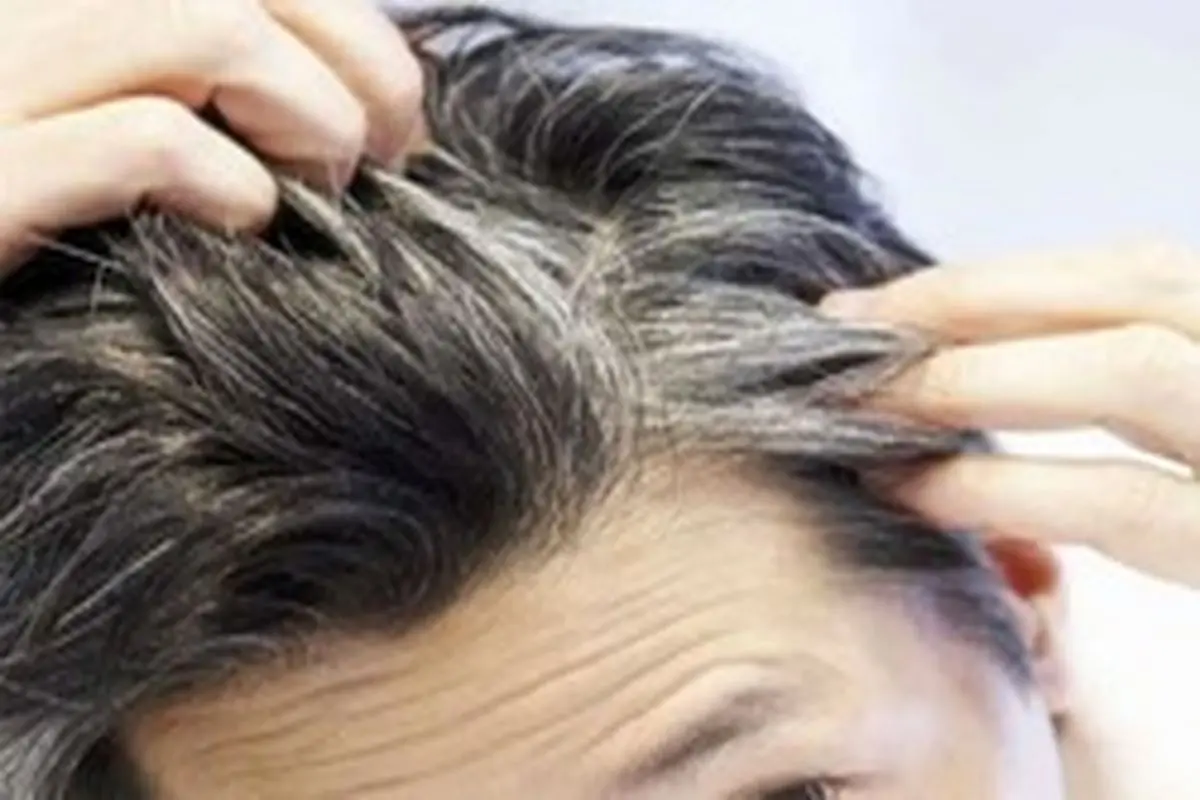 علل سفید شدن زودهنگام مو‌ها چیست؟