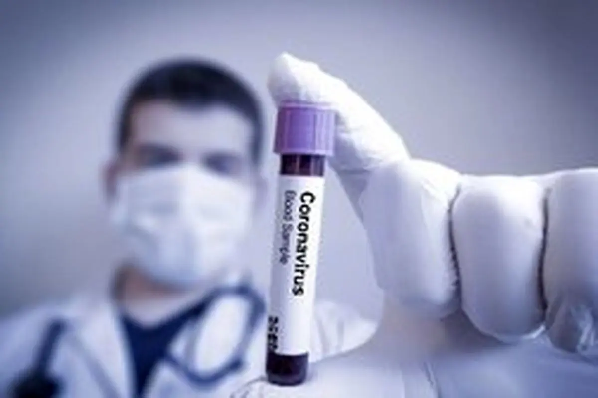 در روسیه اعلام شد؛ نتایج آزمایش موفقیت‌آمیز داروی «آویفاویر» در درمان کرونا