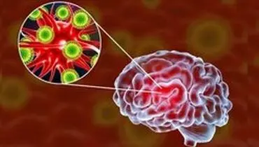 یکی از تاثیرات جدید کرونا: بیماران دچار فراموشی می‌شوند