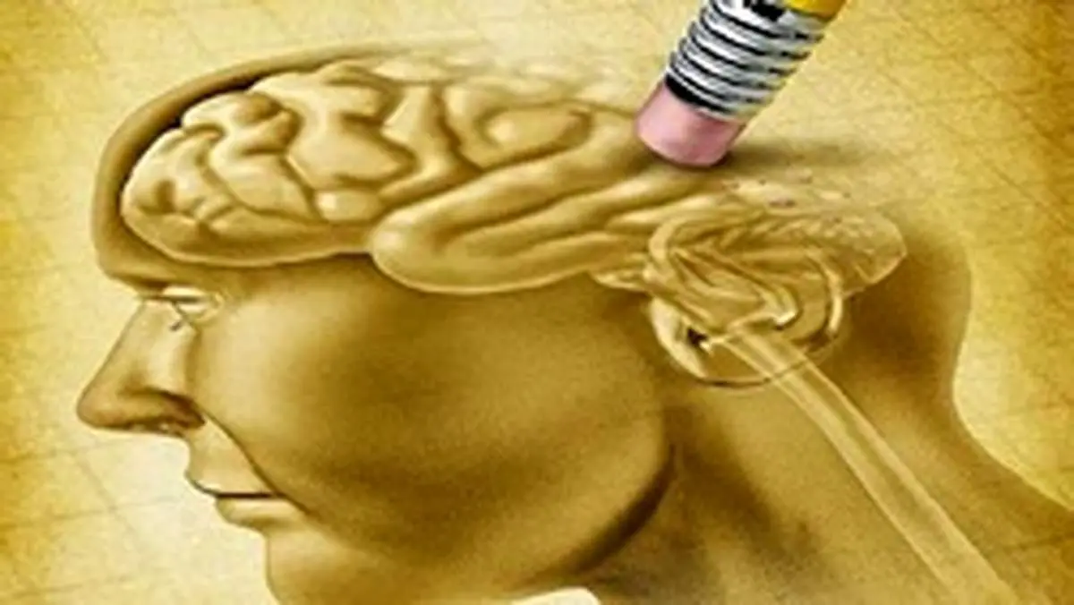 علائمی که خبر از شروع آلزایمر میدهند