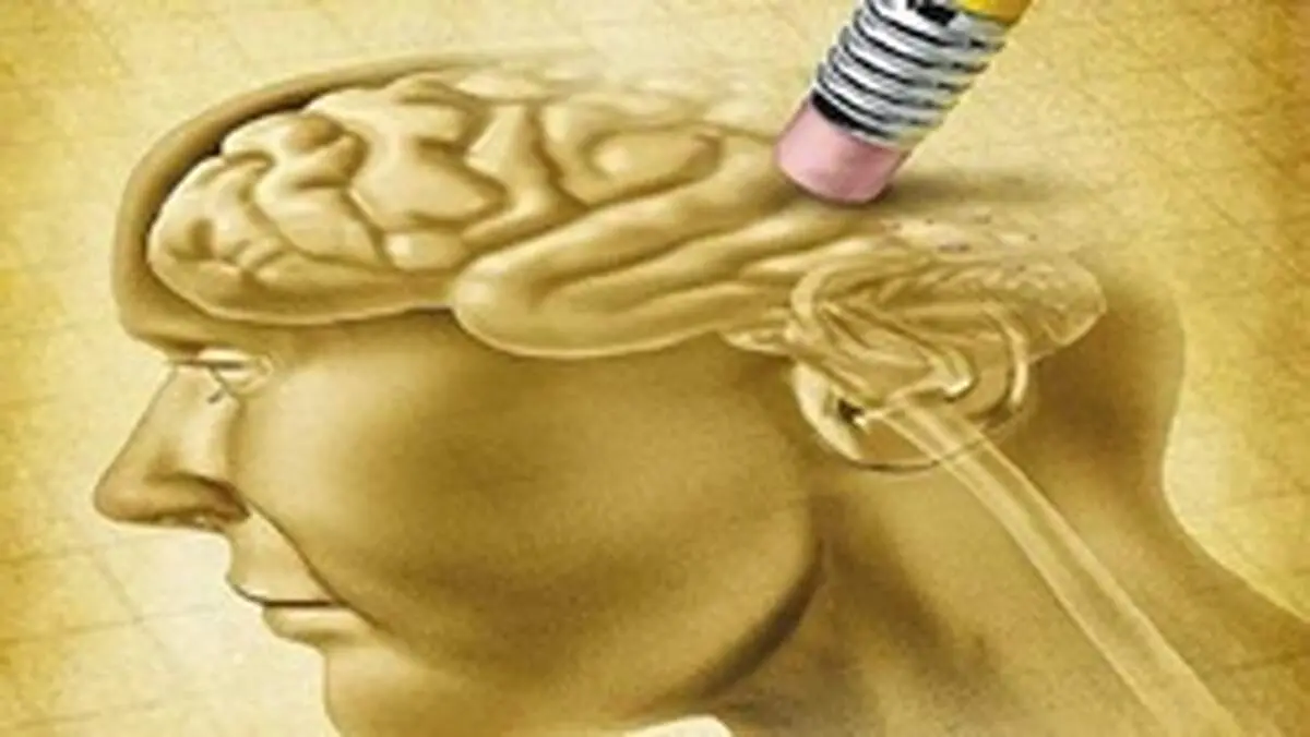 علائمی که خبر از شروع آلزایمر می‌دهند