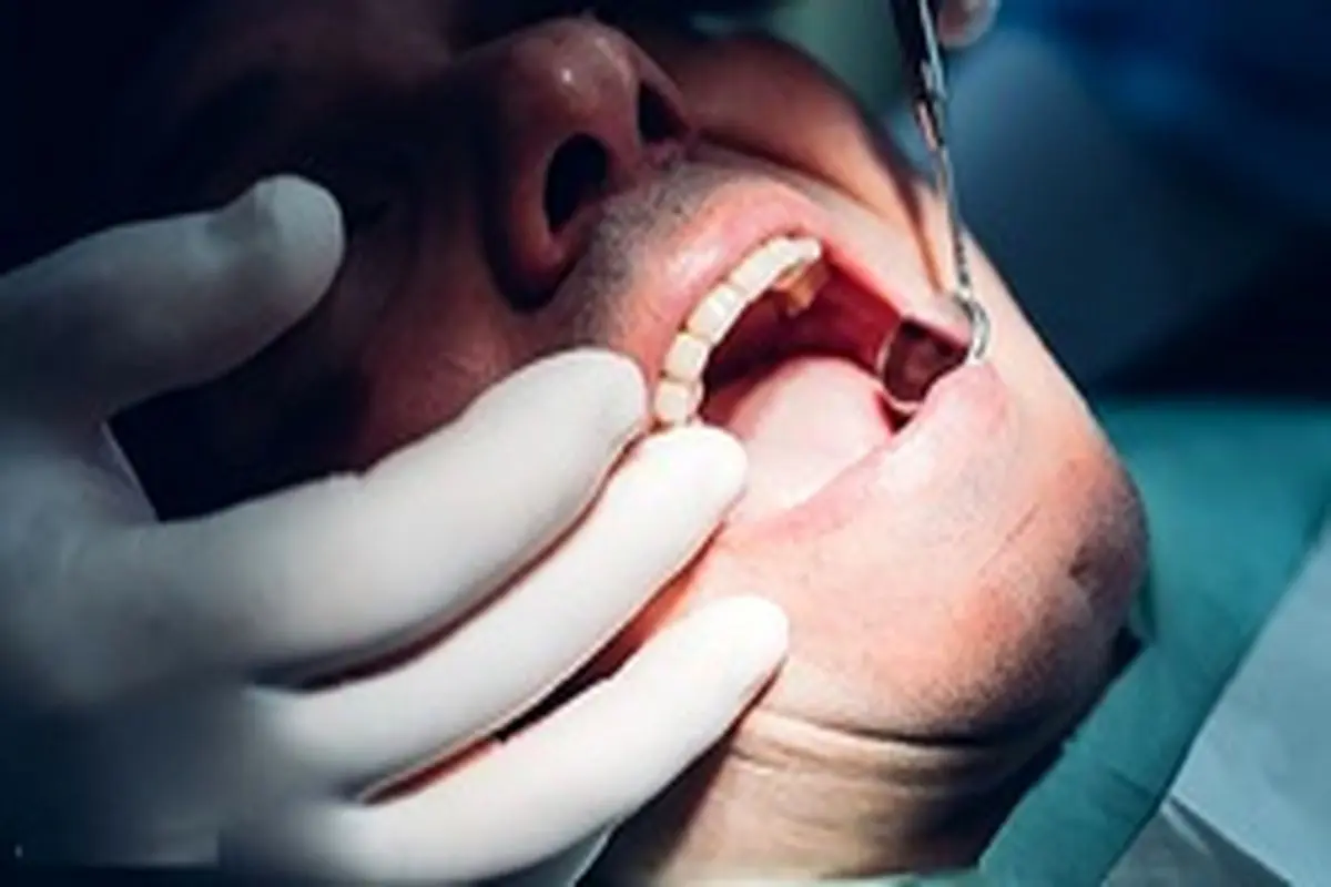 هشدار سازمان جهانی بهداشت درباره مراجعه به دندانپزشکی در روز‌های کرونایی