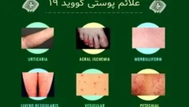 توجه به علائم پوستی در شرایط کرونایی