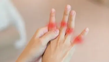علائم عجیب نقرس چیست؟ + روش درمان نقرس