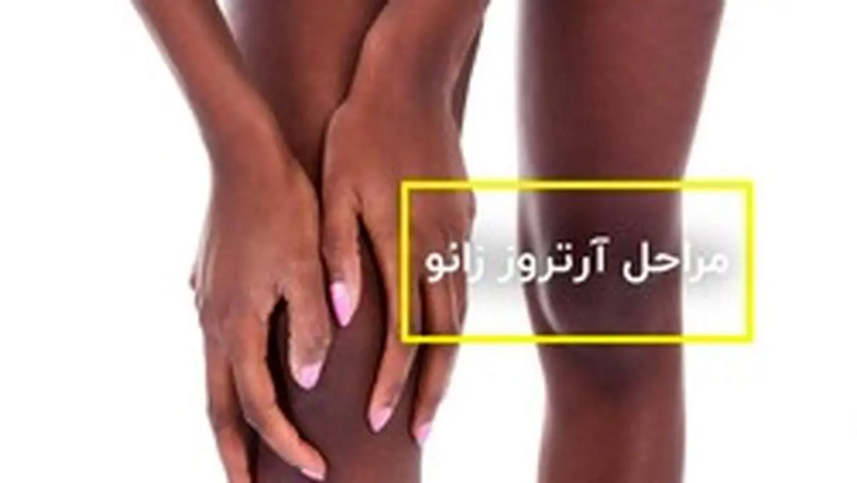 کلینک فیزیوتراپی دایان
درمان فیزیوتراپی آرتروز زانو