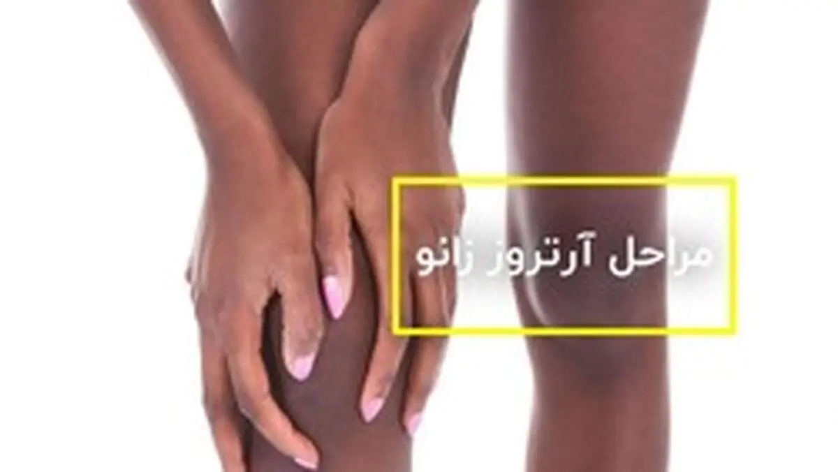 کلینک فیزیوتراپی دایان 
درمان فیزیوتراپی آرتروز زانو
