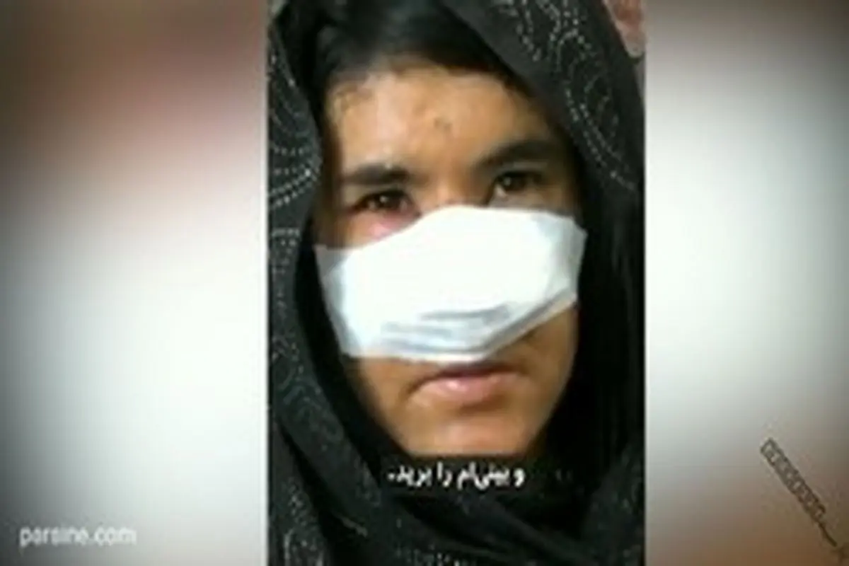 بریدن بینی زن افغان توسط شوهر بدبین+ فیلم