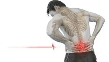 راهکار‌هایی برای کاهش احتمال ابتلا به دیسک کمر