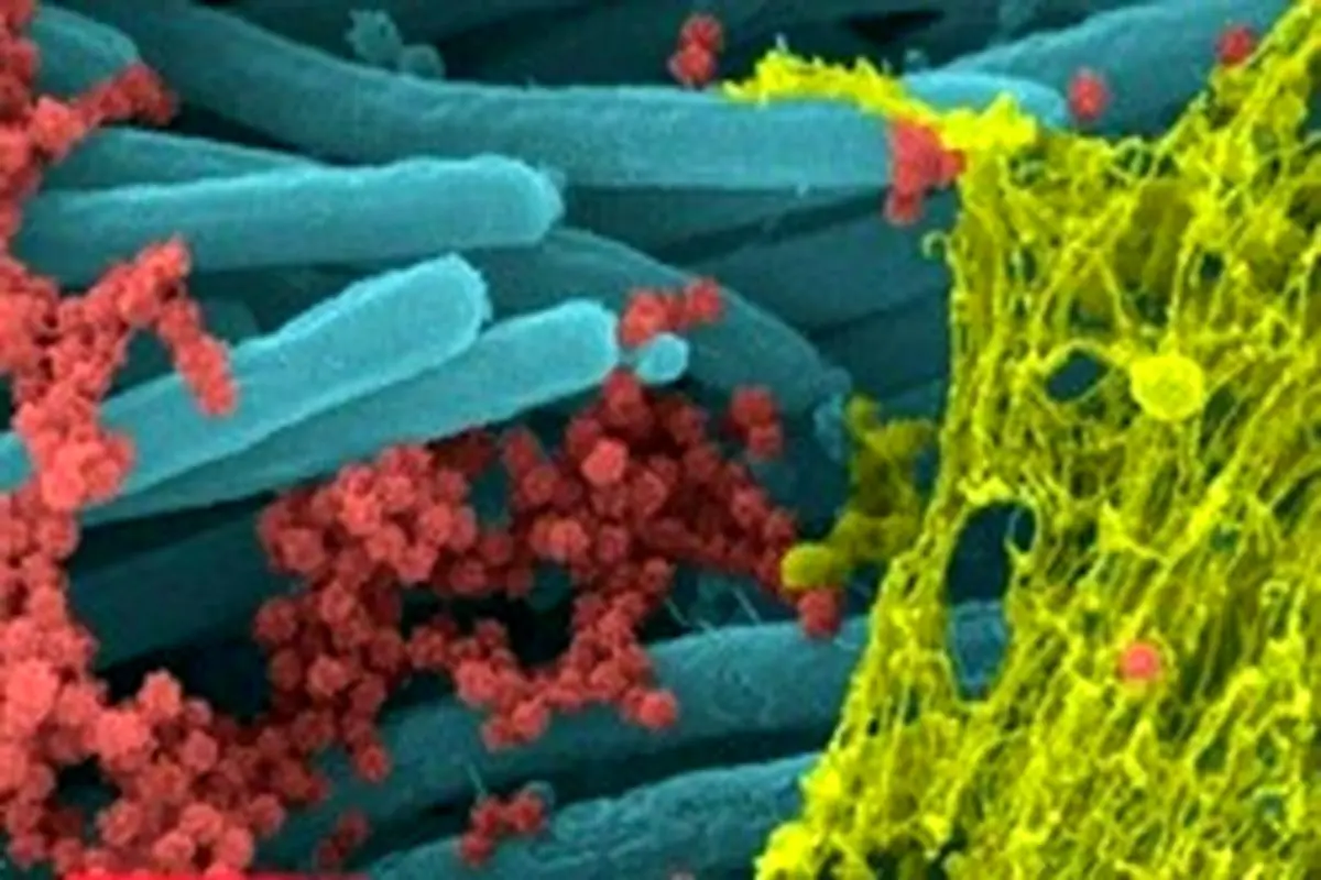 تصاویر سلول‌های آلوده به "کروناویروس سندرم حاد تنفسی ۲"+ عکس