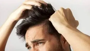 راهکارهای پیشگیری از ریزش مو در مردان