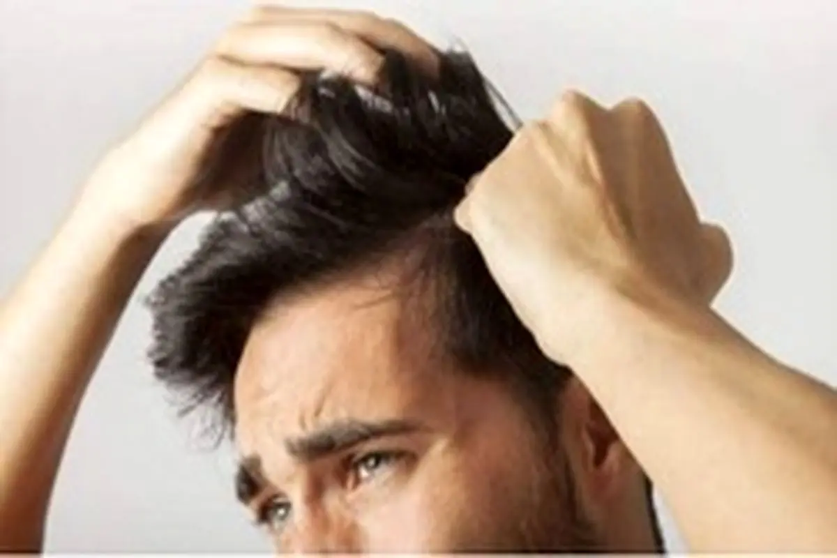 راهکارهای پیشگیری از ریزش مو در مردان