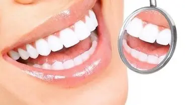 چه کنیم عفونت لثه نگیریم؟ 